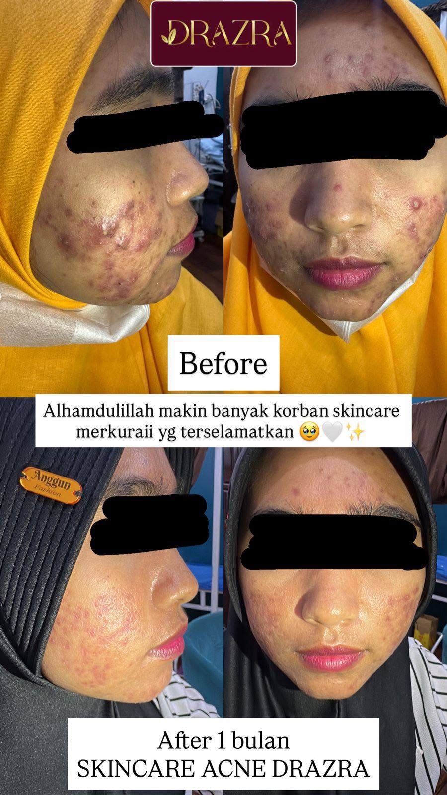 Testimoni DRAZRA 2