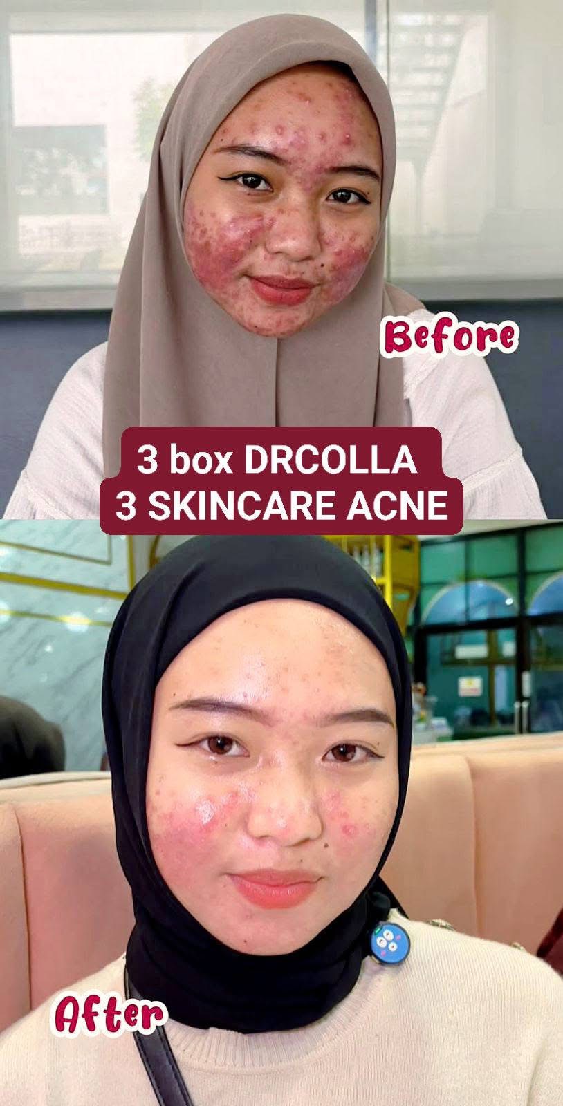 Testimoni DRAZRA 4